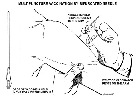 Smallpox vaccination